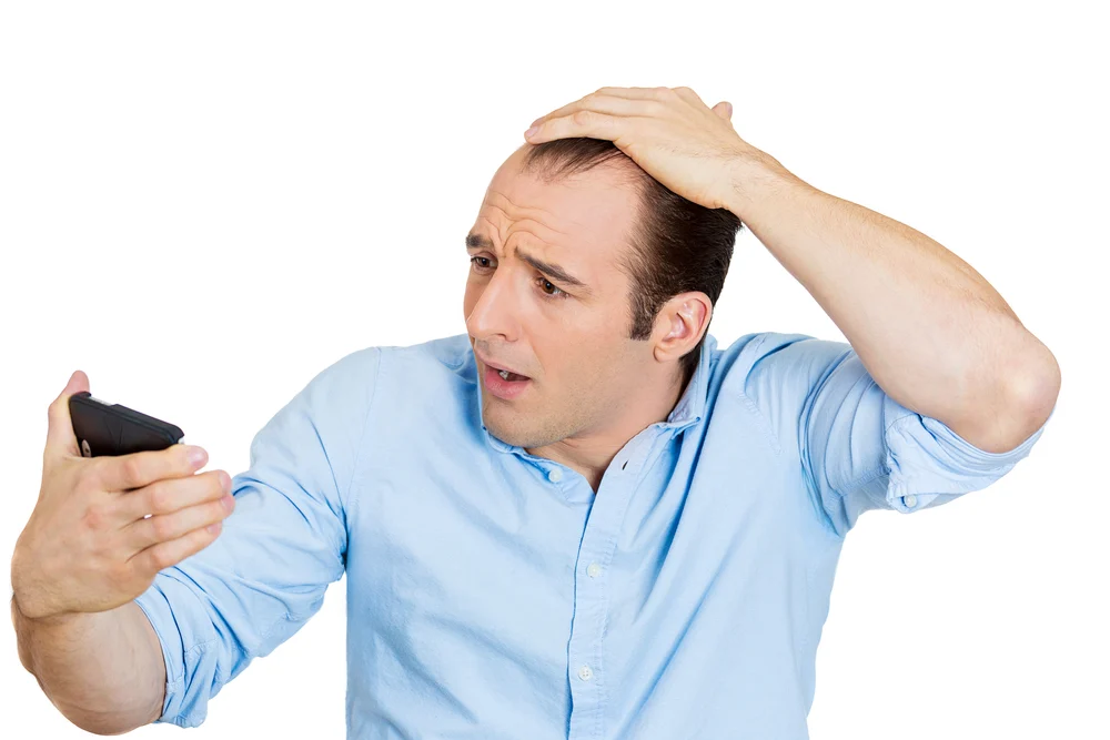 Closeup portrait of shocked man feeling head, surprised he is losing hair, receding hairline or seeing bad news on cellphone, isolated on white background.